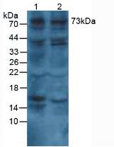 Polyclonal Antibody to Collagen Type VIII Alpha 1 (COL8a1)