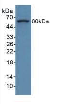 Polyclonal Antibody to Collagen Type VIII Alpha 1 (COL8a1)