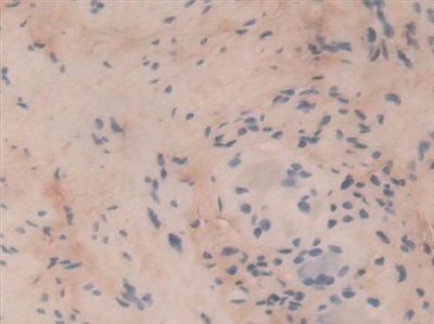 Polyclonal Antibody to Collagen Type VI Alpha 3 (COL6a3)