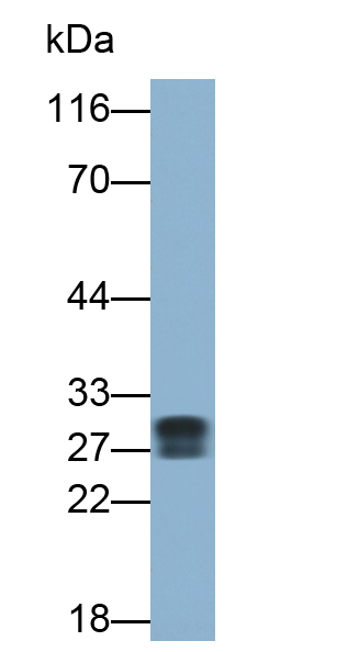 Polyclonal Antibody to HLA Class II Histocompatibility Antigen, DR Alpha Chain (HLA-DRA)