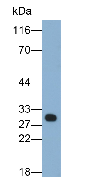 Polyclonal Antibody to HLA Class II Histocompatibility Antigen, DR Alpha Chain (HLA-DRA)