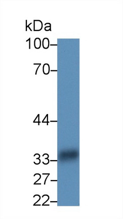 Polyclonal Antibody to HLA Class II Histocompatibility Antigen, DR Alpha Chain (HLA-DRA)