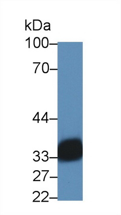 Polyclonal Antibody to HLA Class II Histocompatibility Antigen, DR Alpha Chain (HLA-DRA)