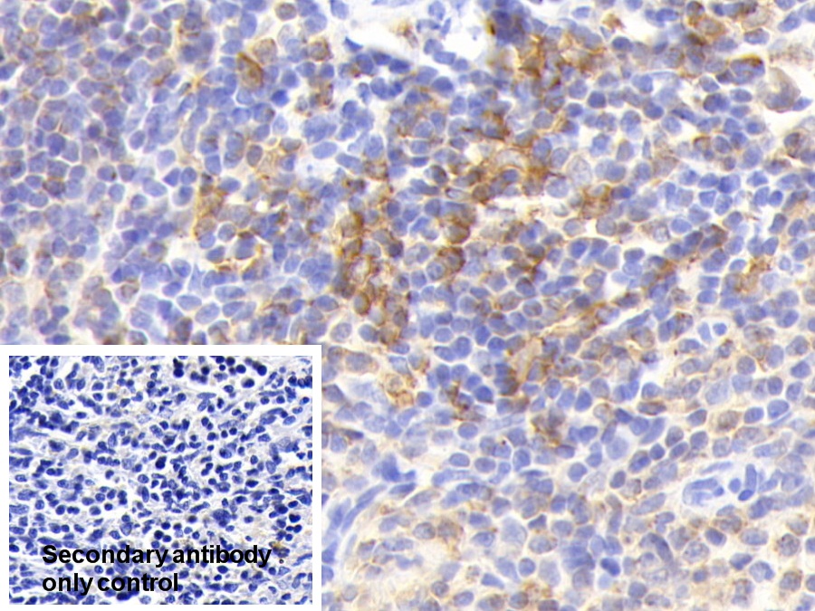 Polyclonal Antibody to HLA Class II Histocompatibility Antigen, DR Alpha Chain (HLA-DRA)