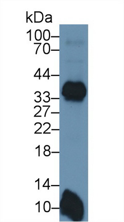 Polyclonal Antibody to HLA Class II Histocompatibility Antigen, DRB1 Beta Chain (HLA-DRB1)