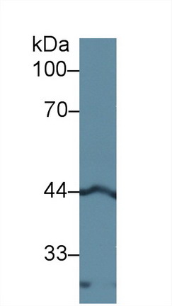 Polyclonal Antibody to Left/Right Determination Factor 1 (LEFTY1)