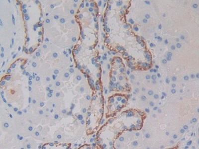 Polyclonal Antibody to C-Met (MET)