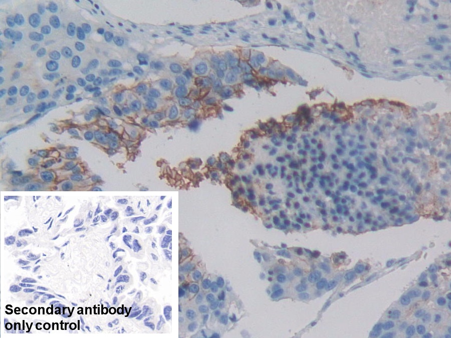 Polyclonal Antibody to C-Met (MET)