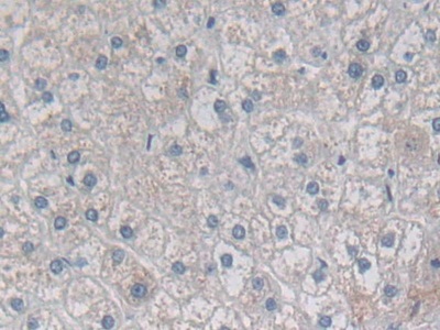 Polyclonal Antibody to Desmoplakin (DSP)