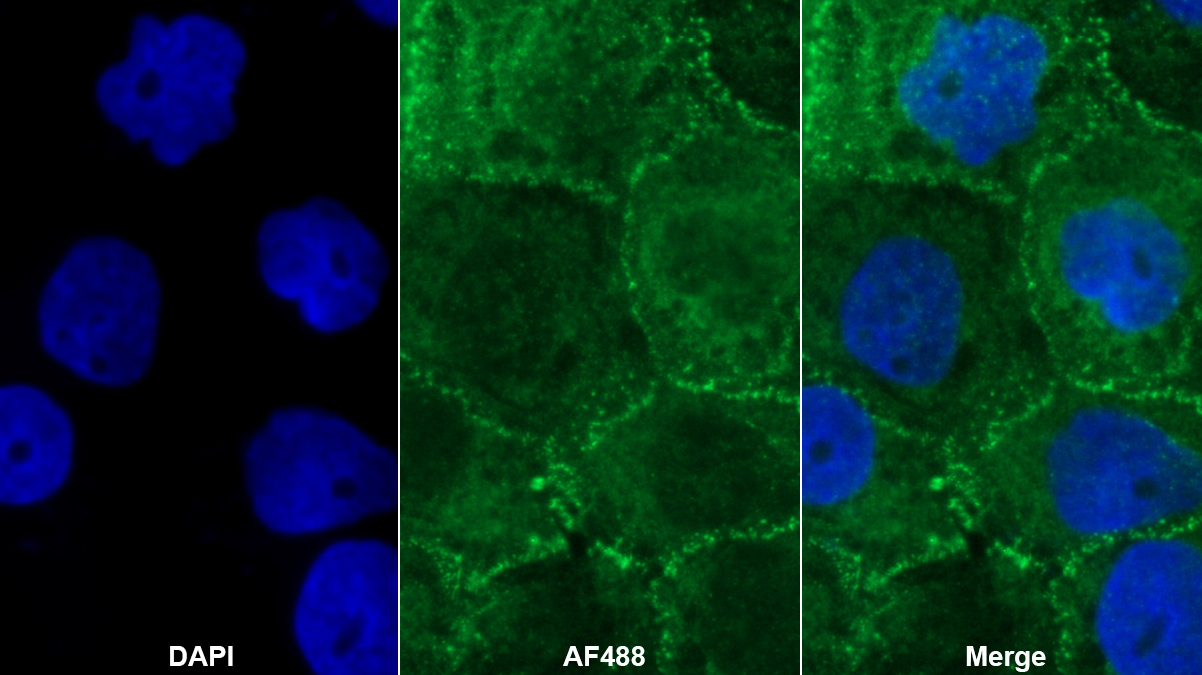 Polyclonal Antibody to Desmoplakin (DSP)