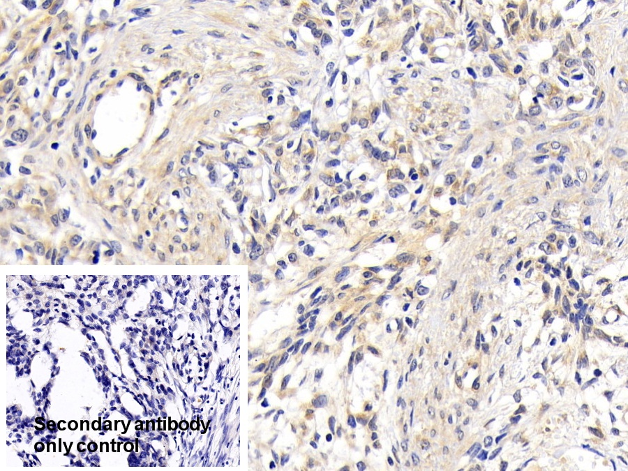 Polyclonal Antibody to Protein Kinase B Alpha (PKBa)