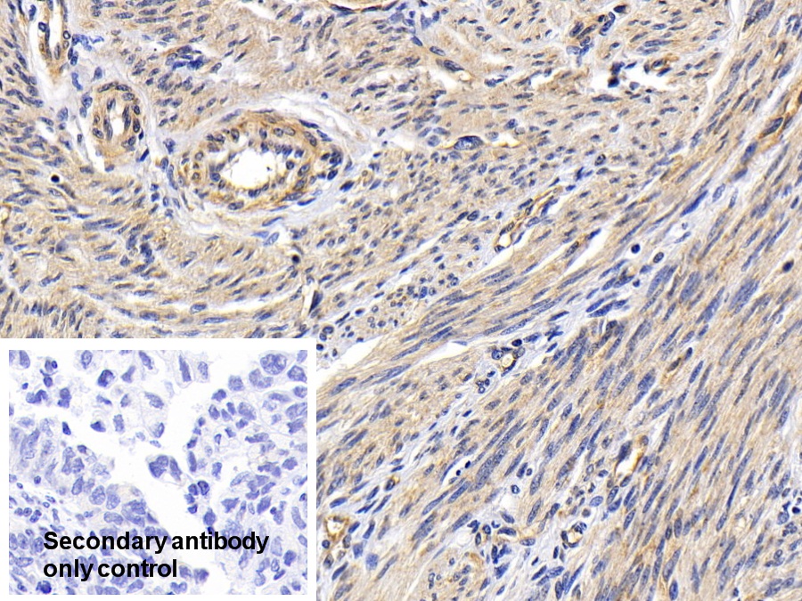 Polyclonal Antibody to Protein Kinase B Alpha (PKBa)