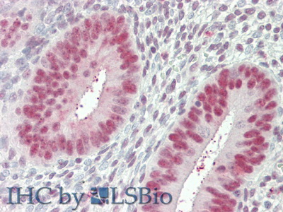 Polyclonal Antibody to Nucleolin (NCL)