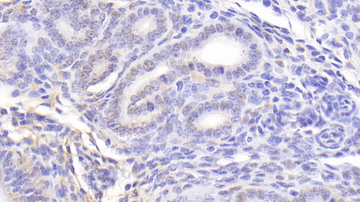 Polyclonal Antibody to Nucleolin (NCL)