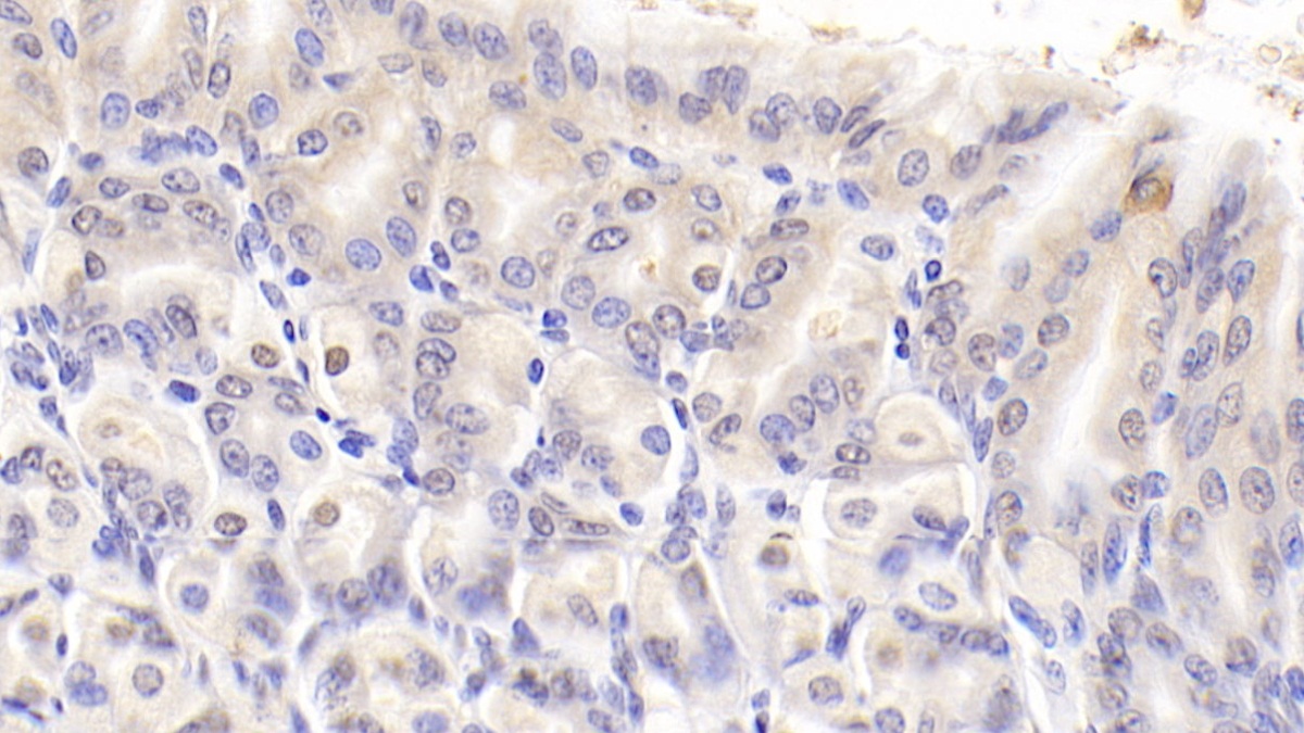 Polyclonal Antibody to Nucleolin (NCL)