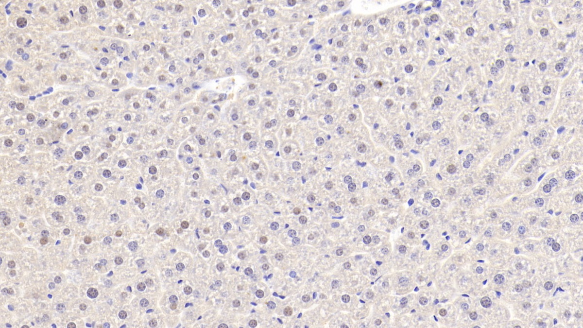 Polyclonal Antibody to Nucleolin (NCL)