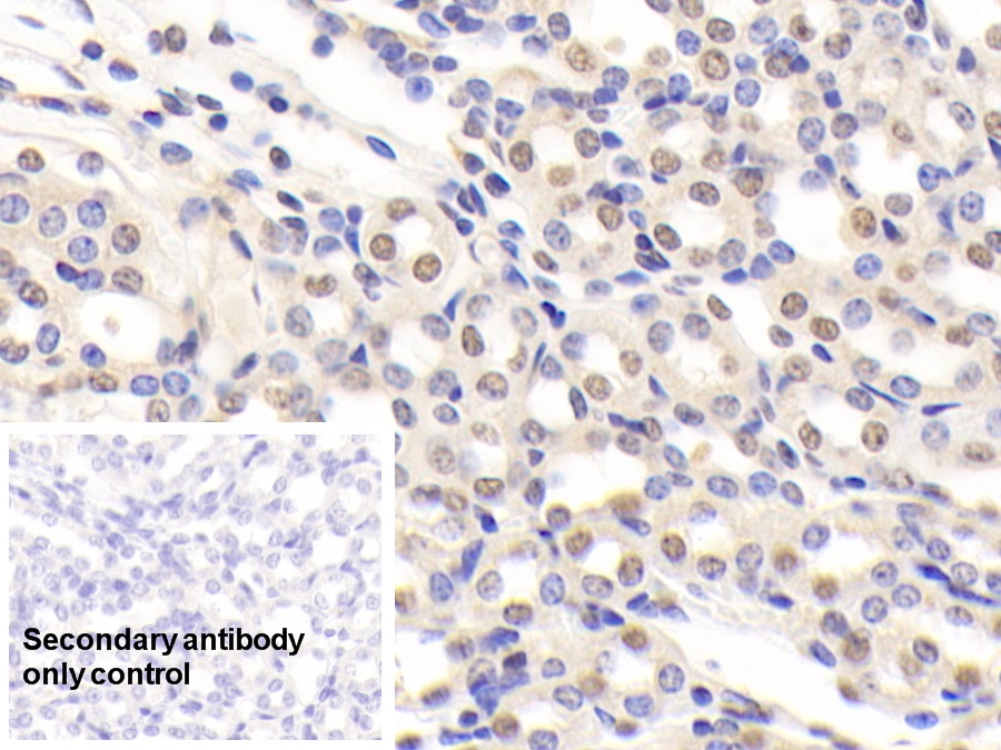 Polyclonal Antibody to Nucleolin (NCL)