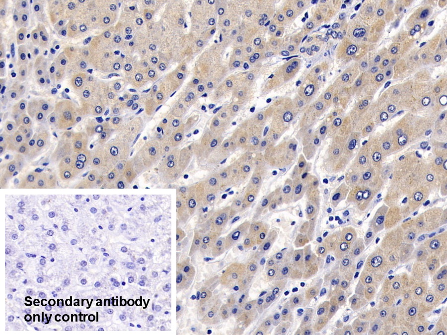 Polyclonal Antibody to Phosphoinositide Dependent Protein Kinase 1 (PDPK1)