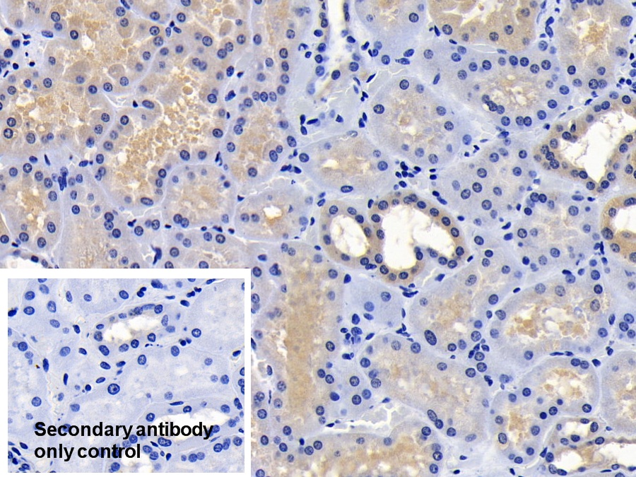 Polyclonal Antibody to Phosphoinositide Dependent Protein Kinase 1 (PDPK1)