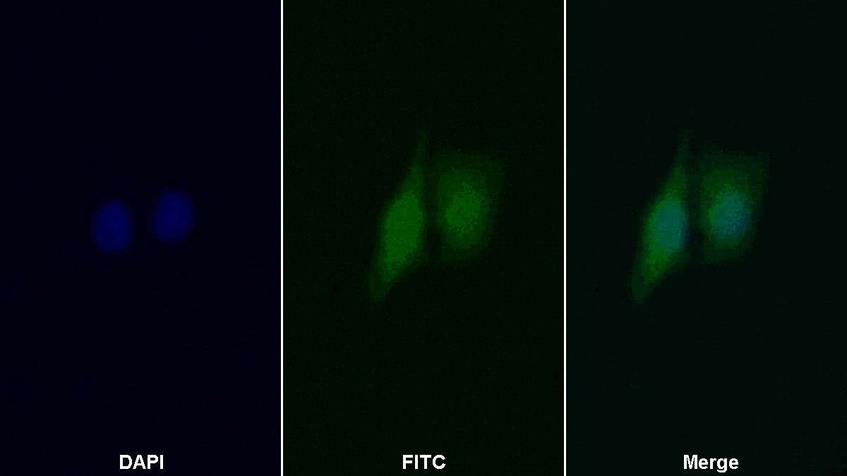 Polyclonal Antibody to Phosphoinositide Dependent Protein Kinase 1 (PDPK1)