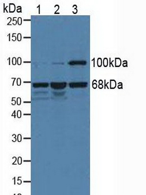 Polyclonal Antibody to Menin (MEAI)