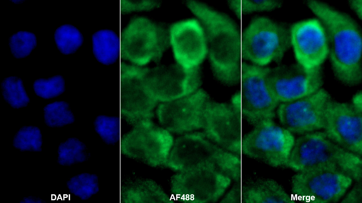 Polyclonal Antibody to Survival Motor Neuron Protein (SMN)