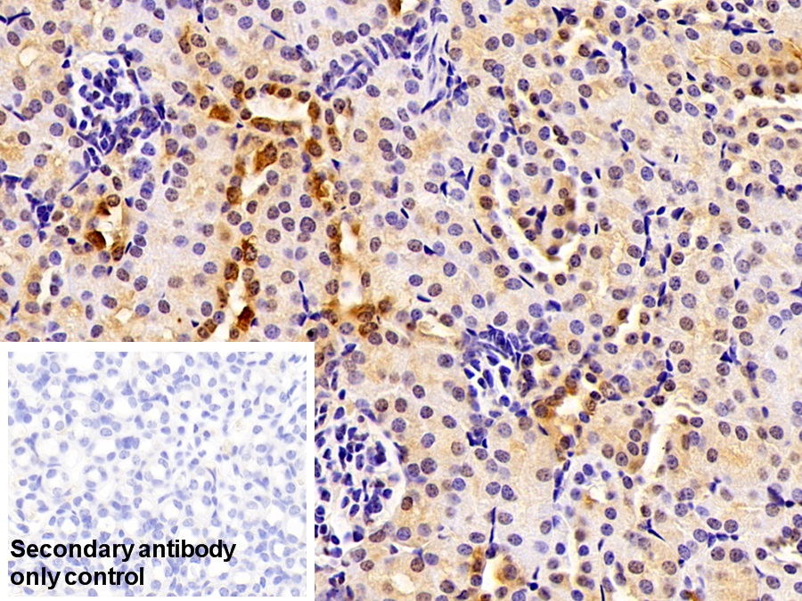 Polyclonal Antibody to Fusion (FUS)