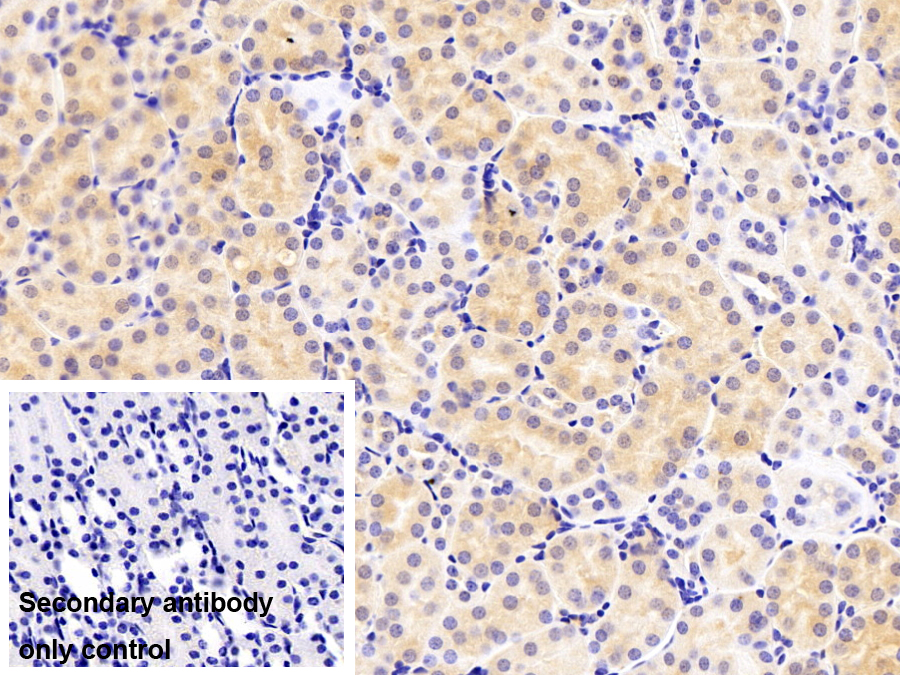 Polyclonal Antibody to 11-Beta-Hydroxysteroid Dehydrogenase Type 1 (HSD11b1)