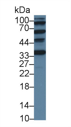 Polyclonal Antibody to Adrenocortical Dysplasia Homolog (ACD)