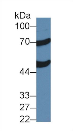 Polyclonal Antibody to Acyl Coenzyme A Oxidase 1, Palmitoyl (ACOX1)