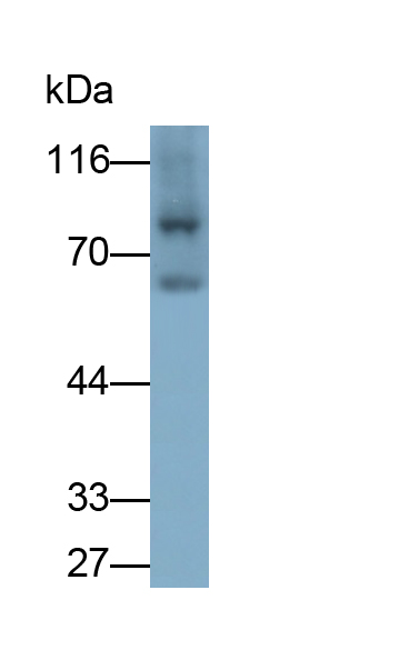 Polyclonal Antibody to Acyl Coenzyme A Oxidase 1, Palmitoyl (ACOX1)