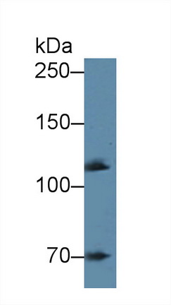 Polyclonal Antibody to Alpha Adducin (ADD1)