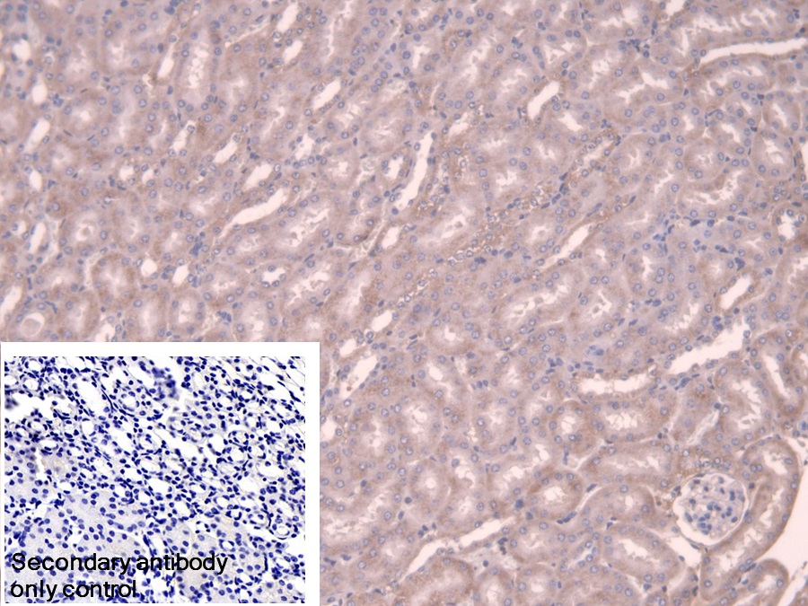 Polyclonal Antibody to Alpha Adducin (ADD1)