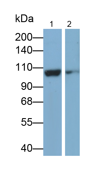 Polyclonal Antibody to Alpha Adducin (ADD1)