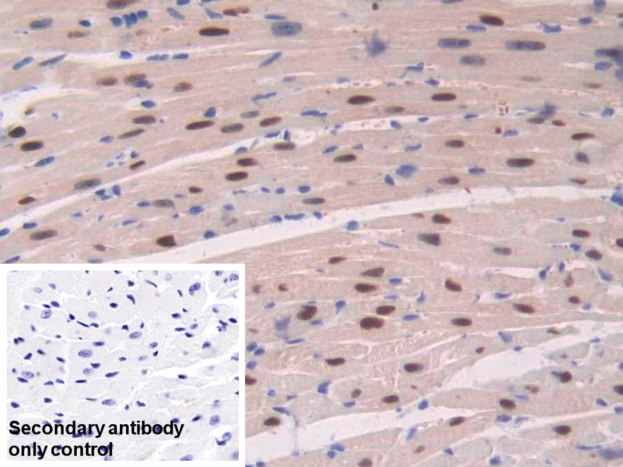 Polyclonal Antibody to Adenosine Kinase (ADK)