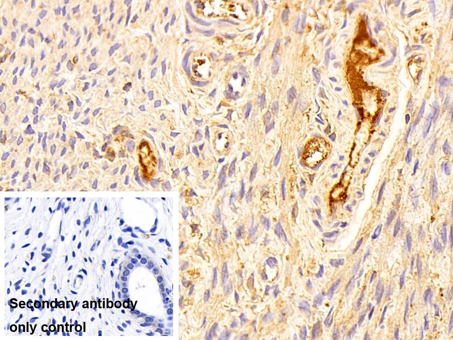 Polyclonal Antibody to Afamin (AFM)