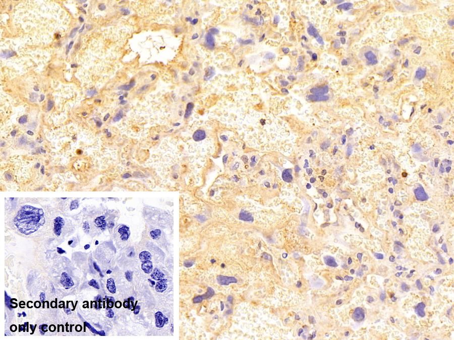 Polyclonal Antibody to Afamin (AFM)