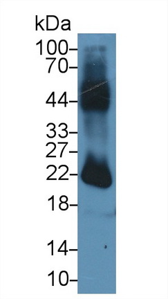 Polyclonal Antibody to Anterior Gradient 2 (AGR2)