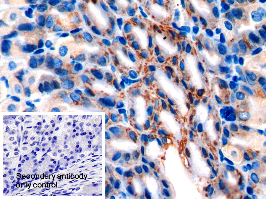 Polyclonal Antibody to Anterior Gradient 2 (AGR2)