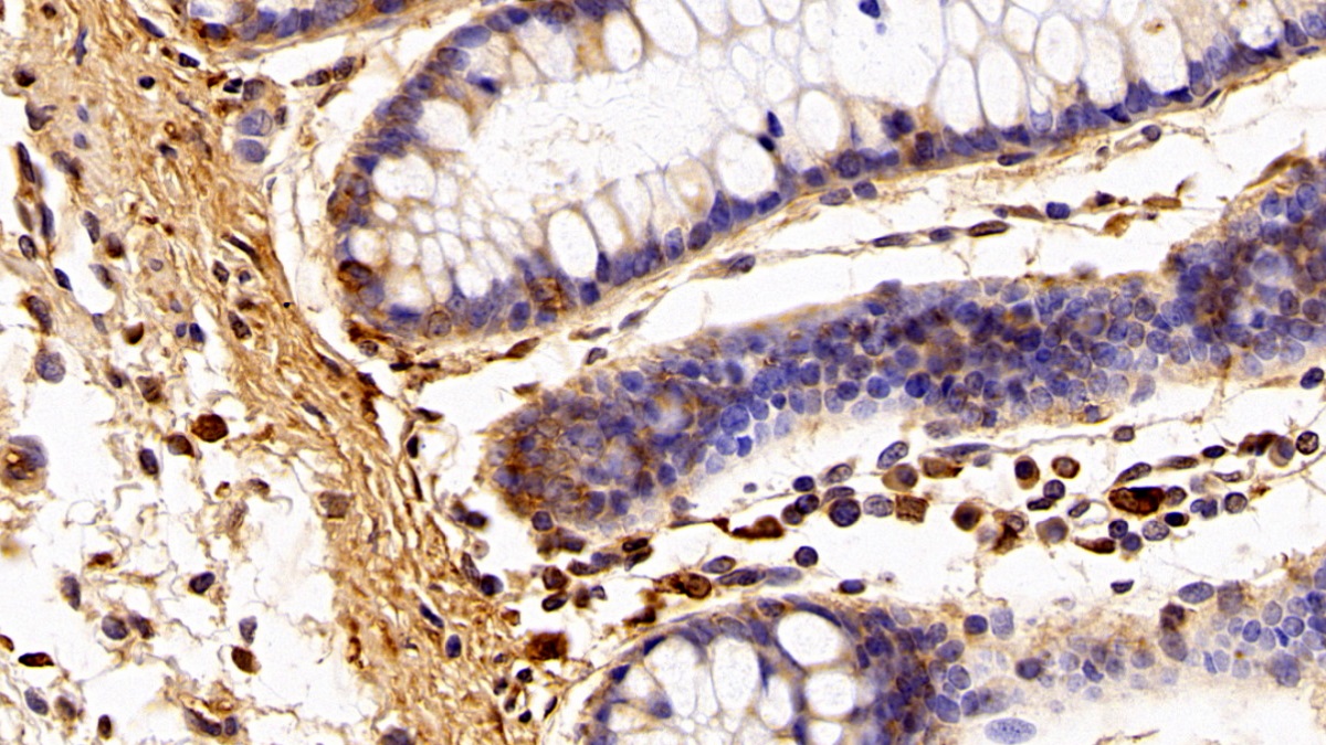 Polyclonal Antibody to Ionized Calcium-binding Adapter Molecule 1 (IBA1)