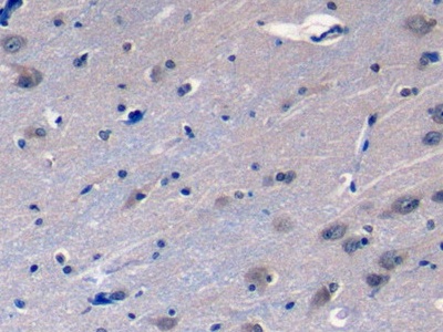 Polyclonal Antibody to Aryl Hydrocarbon Receptor Interacting Protein (AIP)
