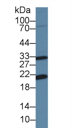 Polyclonal Antibody to Apolipoprotein M (APOM)