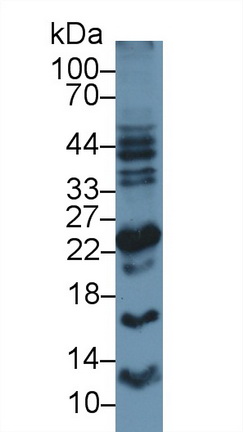 Polyclonal Antibody to Apolipoprotein M (APOM)