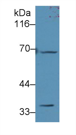 Polyclonal Antibody to Adenine Phosphoribosyltransferase (APRT)