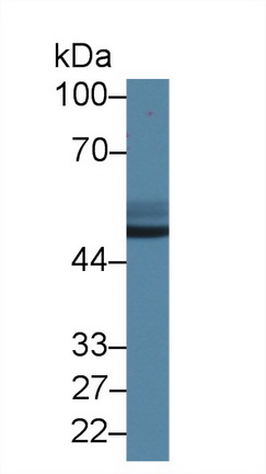 Polyclonal Antibody to Antithrombin (AT)