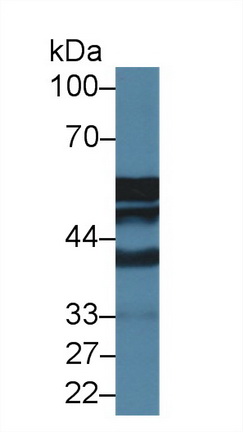 Polyclonal Antibody to Antithrombin (AT)