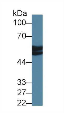 Polyclonal Antibody to Antithrombin (AT)