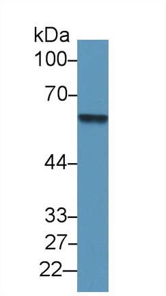 Polyclonal Antibody to Antithrombin (AT)