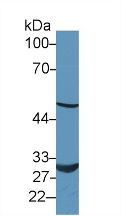 Polyclonal Antibody to Antithrombin (AT)