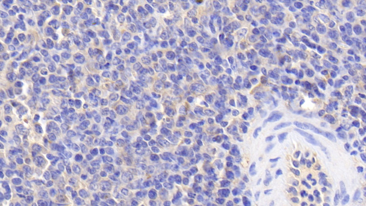 Polyclonal Antibody to Antithrombin (AT)